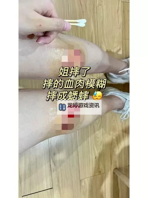 真实破外女摘花流血了:事件背后的真相与反思图1