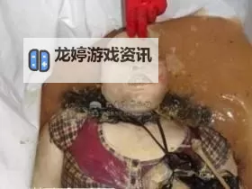 浴室自杀22天:一段未解之谜的心理阴影图1